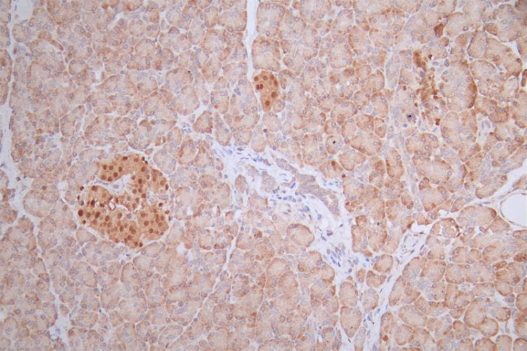 Pax6 Antibody (22C3)