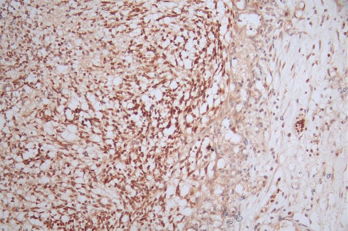 Pax6 Antibody (22C3)