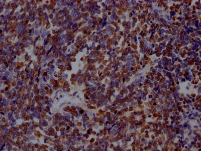 PARP Antibody (7C11)