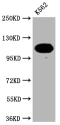 PARP Antibody (8C7)