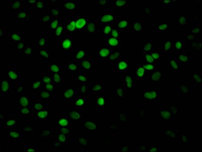 PARP Antibody (8C7)