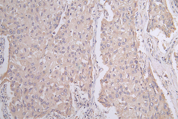 Pannexin-1 Antibody (28G5)