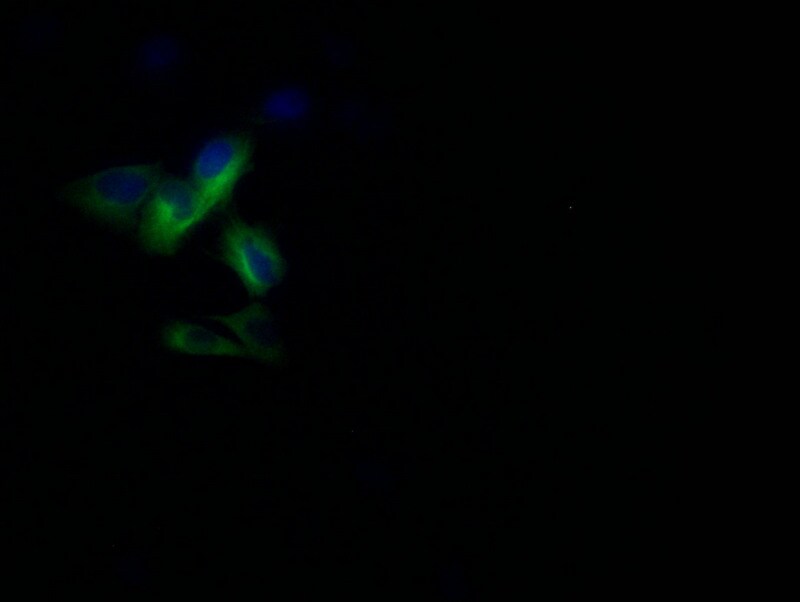 Pannexin-1 Antibody (28G5)