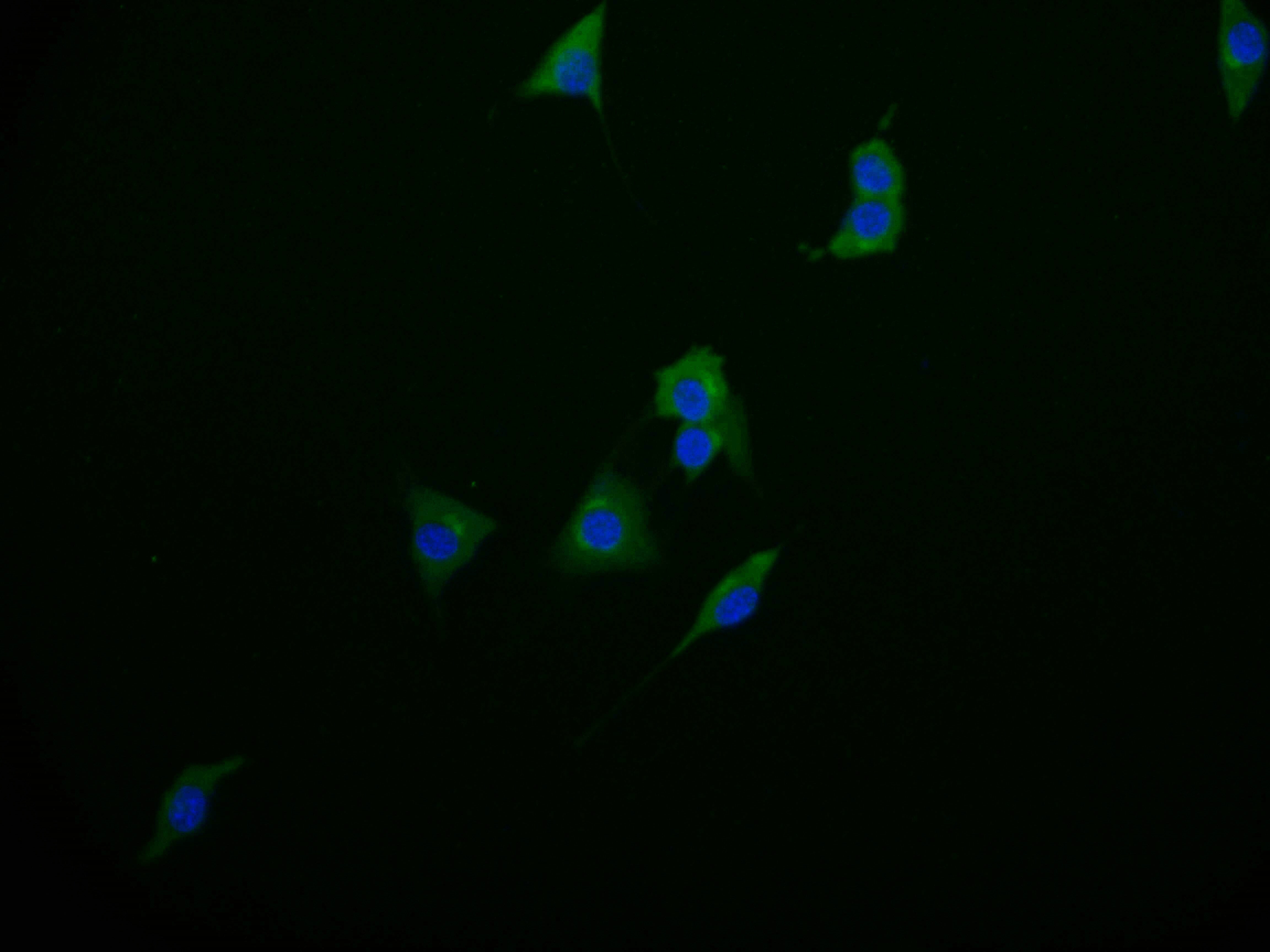 Phenylalanine Hydroxylase Antibody (17D10)