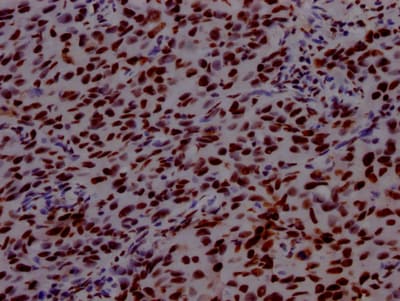 PABPN1 Antibody (6C3)