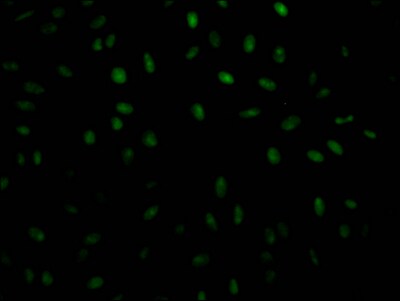 PABPN1 Antibody (6C3)