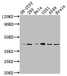 delta Opioid R/OPRD1 Antibody (7G7)