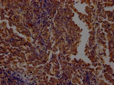O-GlcNAc Transferase p110 subunit Antibody (8G7)