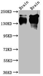 TrkA Antibody (2A5)