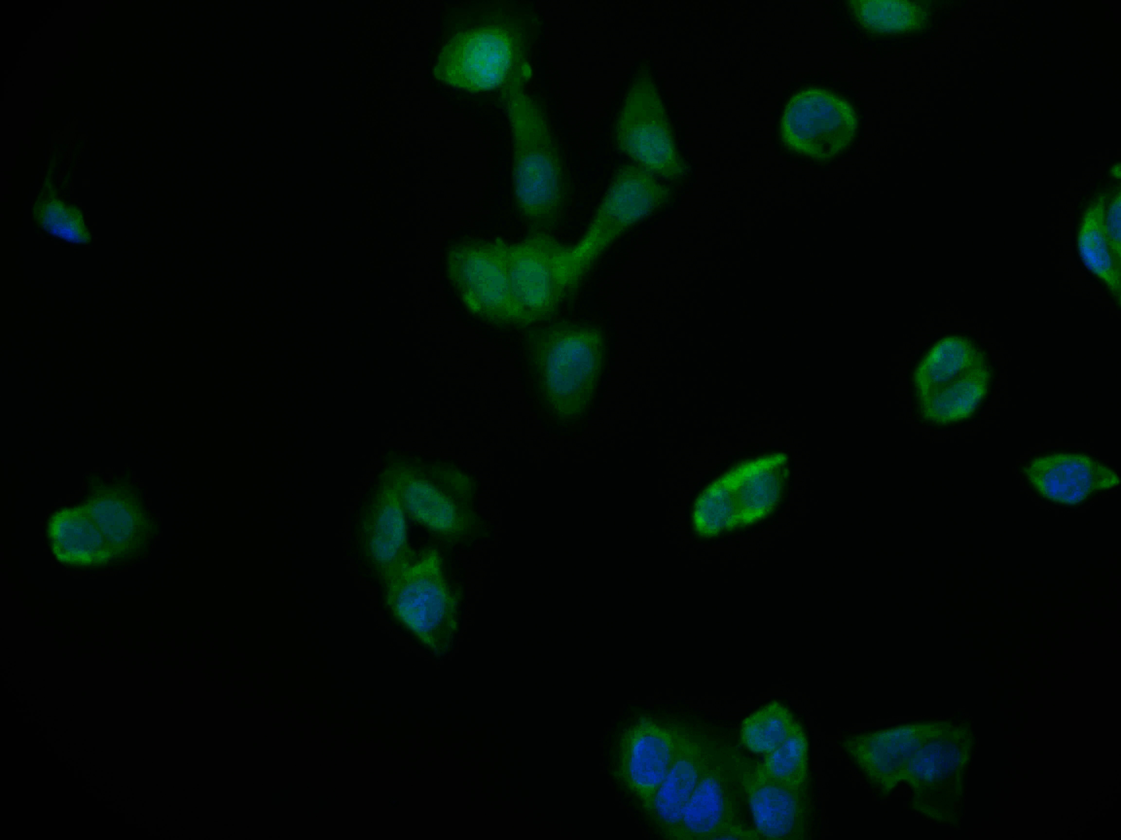 NTH1 Antibody (22H10)