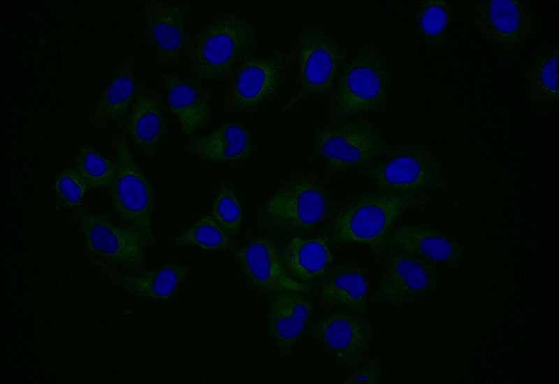 NPRB/NPR2 Antibody (19C7)