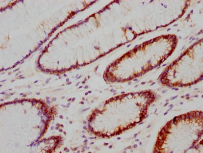 Carbonic Anhydrase IX/CA9 Antibody (4F12)