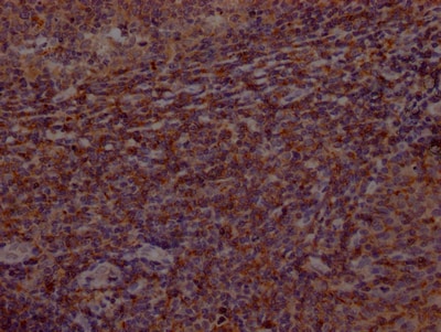 BTK Antibody (3E5)