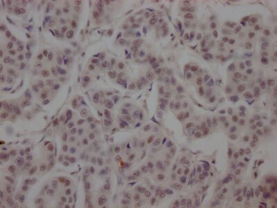 BRD4 Antibody (1E5)