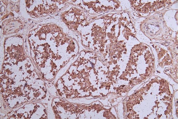 Bcl-6 Antibody (6E3)