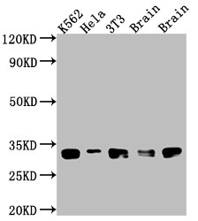 bcl-x Antibody (5E9)