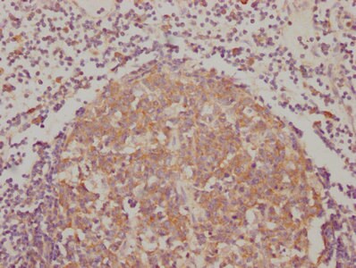 BAK Antibody (8D1)