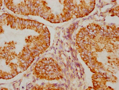 BAK Antibody (8D1)