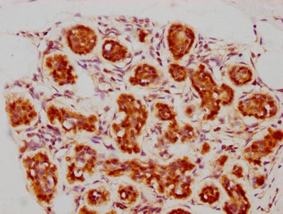 BAG3 Antibody (3D8)