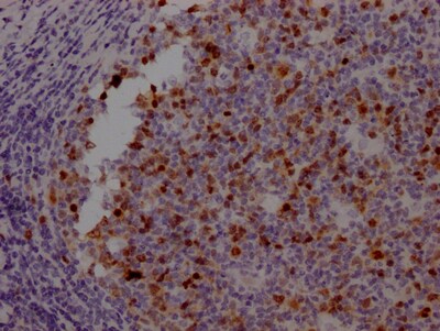Aurora B Antibody (4E5)