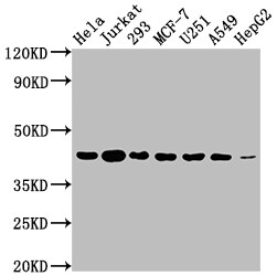 Aurora B Antibody (4E5)