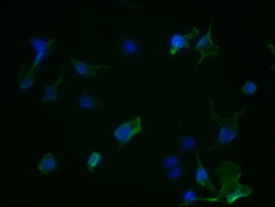Aurora A Antibody (1H8)