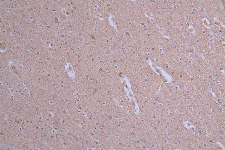 ATP7b Antibody (36D12)