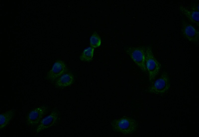 ATP7b Antibody (36D12)