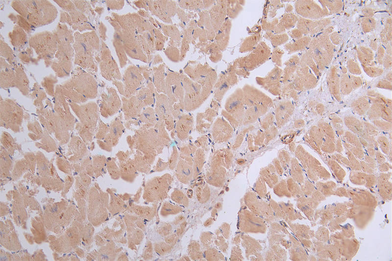SERCA2 ATPase Antibody (20D1)