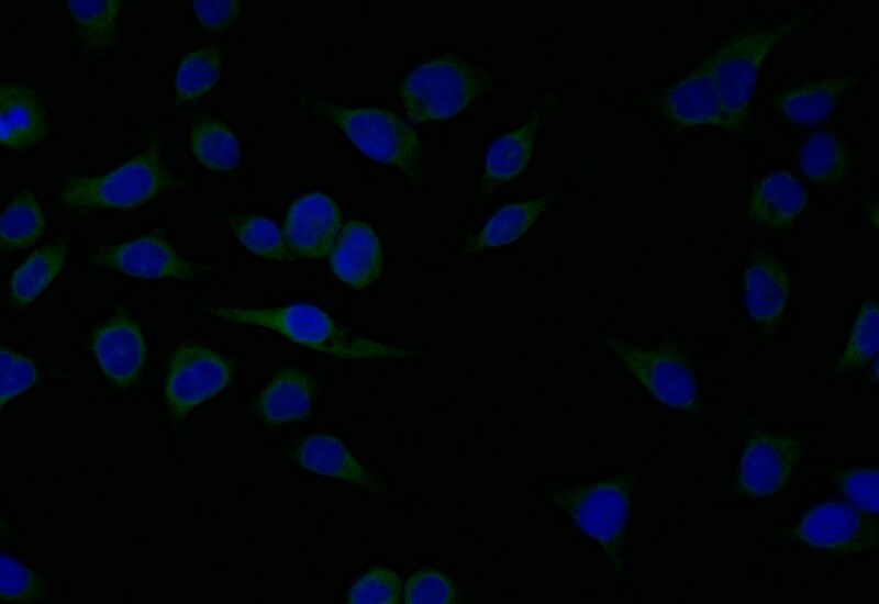 SERCA2 ATPase Antibody (20D1)
