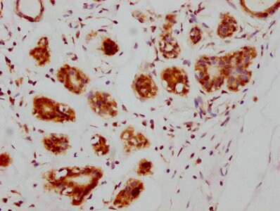 ATM Antibody (4E11)