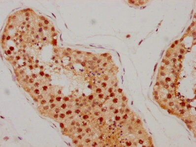 ATM Antibody (4E11)
