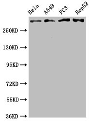 ATM Antibody (4E11)