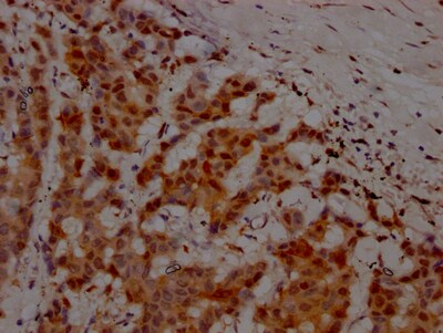 ATM Antibody (3G11)