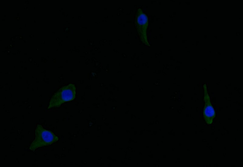 Argininosuccinate Synthase Antibody (18G11)