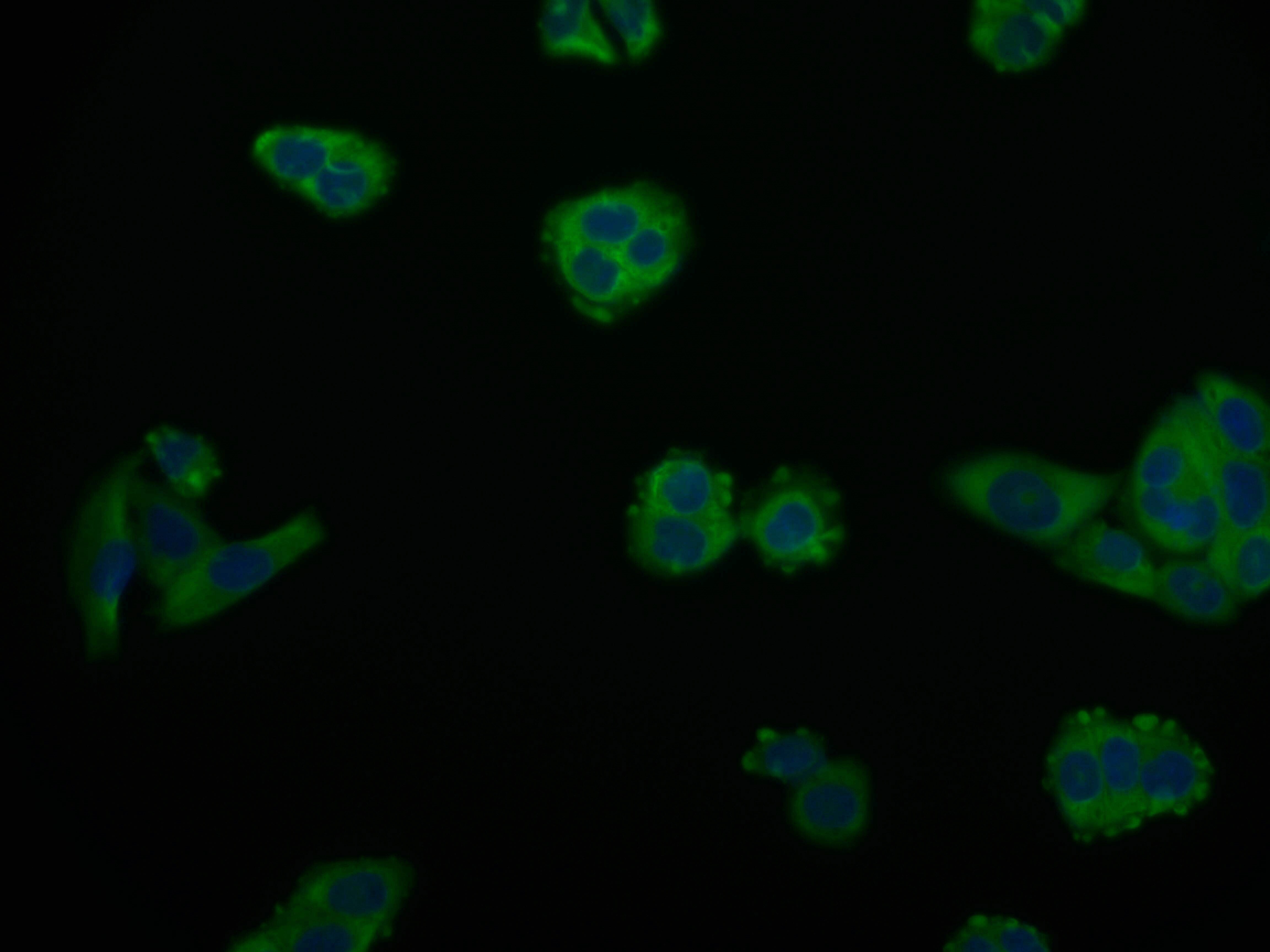 ARG2 Antibody (9A4)