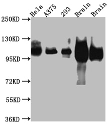 APP Antibody (6F10)