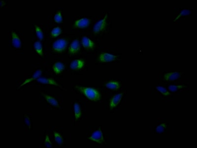 APP Antibody (6F10)
