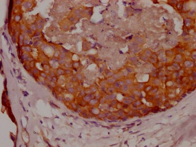 APC Antibody (5F2)