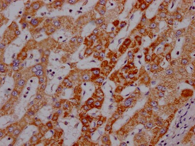 Angiopoietin-2 Antibody (1F10)