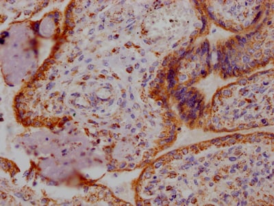 Angiopoietin-2 Antibody (1F10)