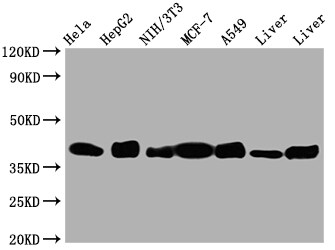 Aldolase A Antibody (7D8)