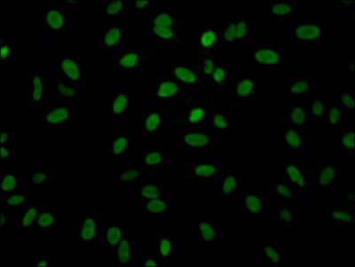 Aldolase A Antibody (7D8)