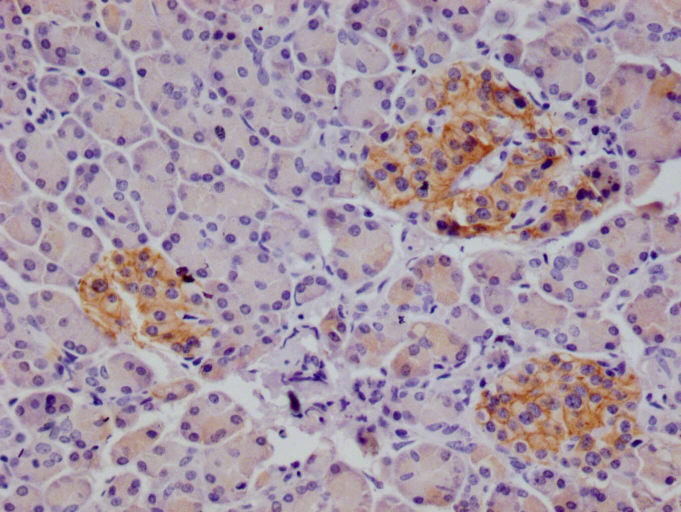 ALCAM/CD166 Antibody (21B9)