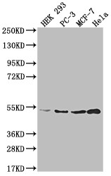 Adenosylhomocysteinase/AHCY Antibody (13H8)