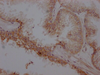 beta-2 Adrenergic R/ADRB2 Antibody (4C11)