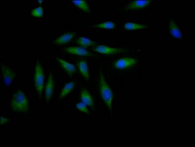 TACE/ADAM17 Antibody (5A1)
