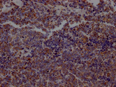 Aconitase 2 Antibody (8H4)