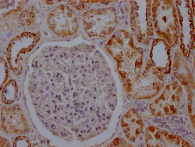 Aconitase 2 Antibody (8H4)