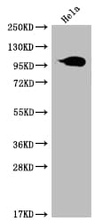 Aconitase 1 Antibody (22C10)